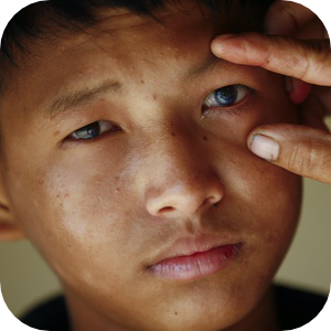   一名眼睛上绑着纱布的小孩正趴在一名妇女的肩头休息，妇女穿着格子衬衫，抱着他穿过一家医疗机构的狭窄走廊，走廊上还能看到一名穿手术服的医疗工作者。这场景表明小孩刚刚接受了眼部手术，正处于术后护理或恢复阶段。